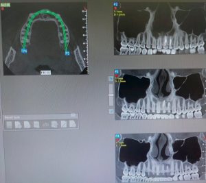 conebeam02-300x267